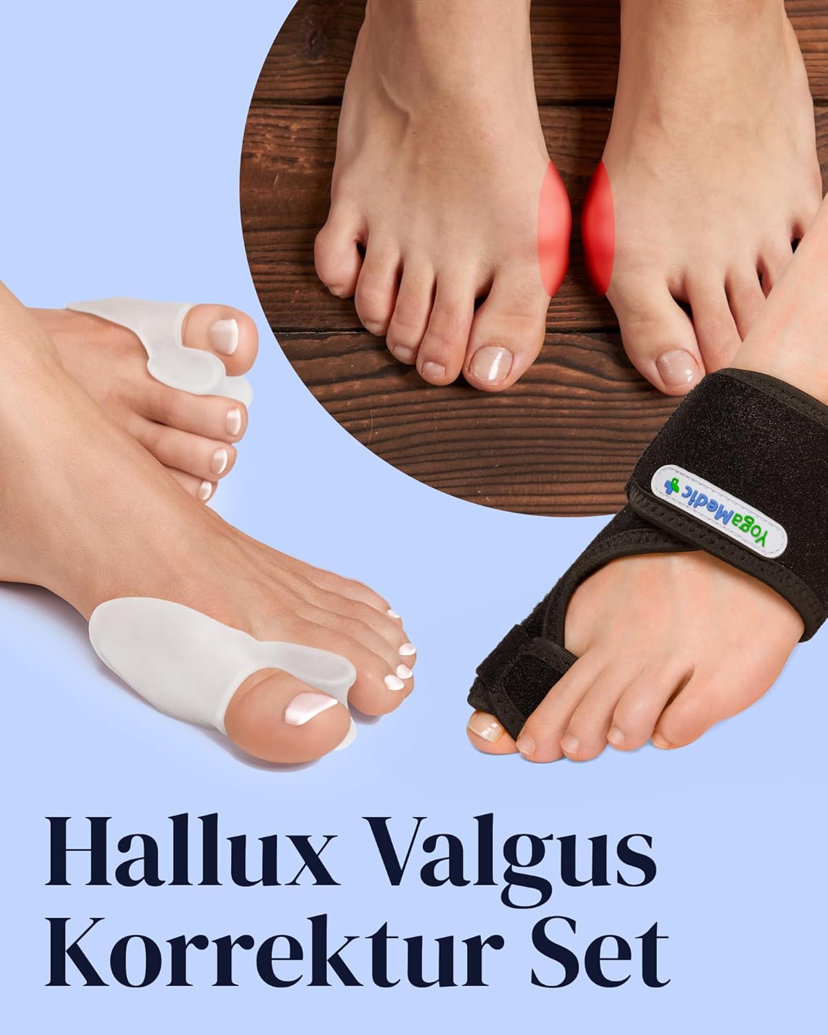 YOGAMEDIC Hallux Valgus korrekciós sín és lábujjelválasztó szett - Univerzális méret, BPA-mentes - Image 2